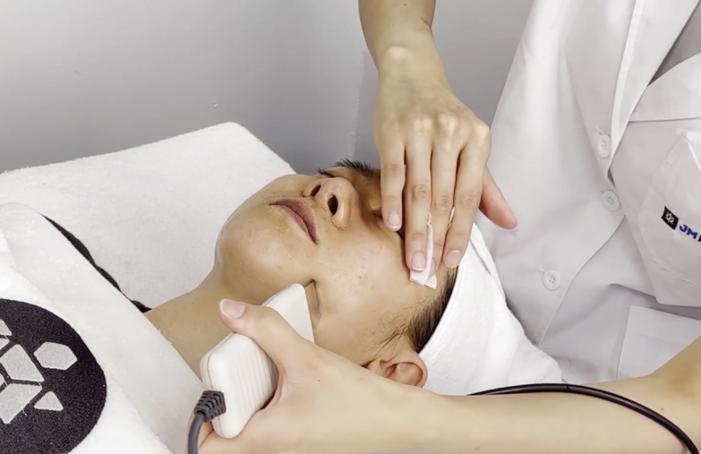 scaling and peeling of skin before receiving acne treatment