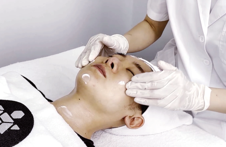 applying sunscreen for UV protection after completing pdt therapy for acne treatment