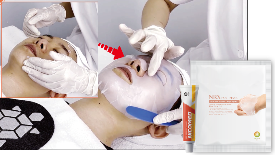 application of RIBESKIN nicomed cream to soothe inflamed skin after pdt therapy for acne treatment